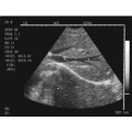 Scanner de ultrassom humano série MT300V